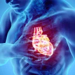 1800ss_getty_rf_cardiac_arrest_illustration-1.webp